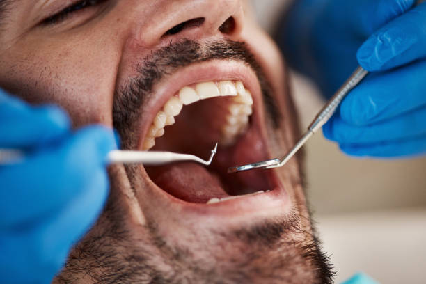 Emergency Dental Services for Seniors